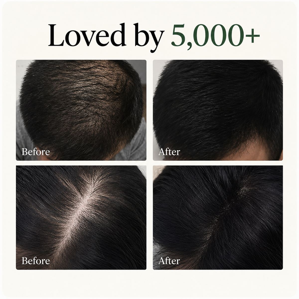 Herbal Scalp Revival Bar