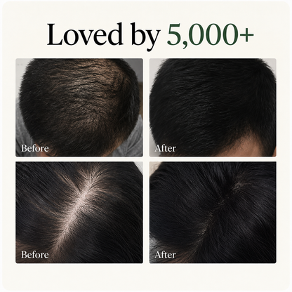 Herbal Scalp Revival Bar
